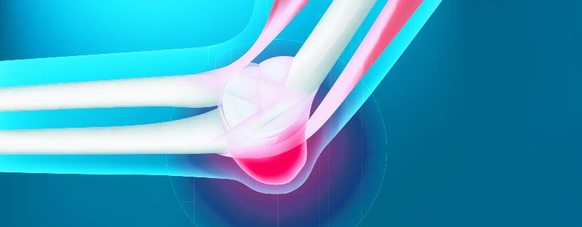 patient needing Bursitis chiropractor in Addison TX