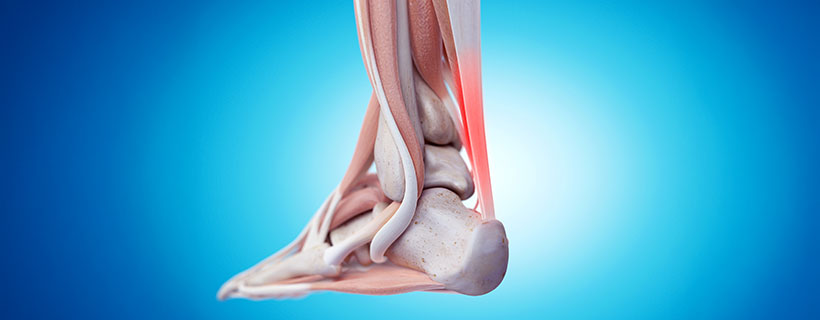 patient needing Tendonitis chiropractor in Addison TX